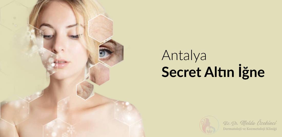 Antalya Secret Altın İğne